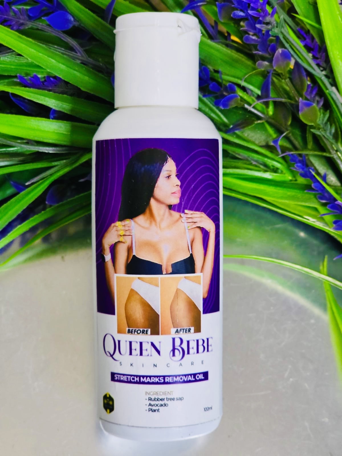 100% Natural Stretch Marks Removal Oil
