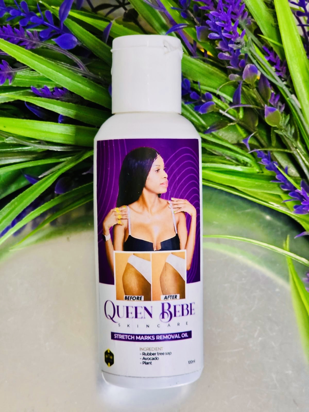 100% Natural Stretch Marks Removal Oil
