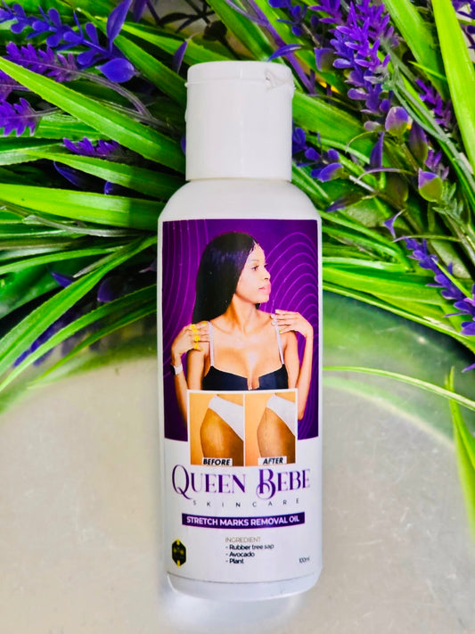 100% Natural Stretch Marks Removal Oil