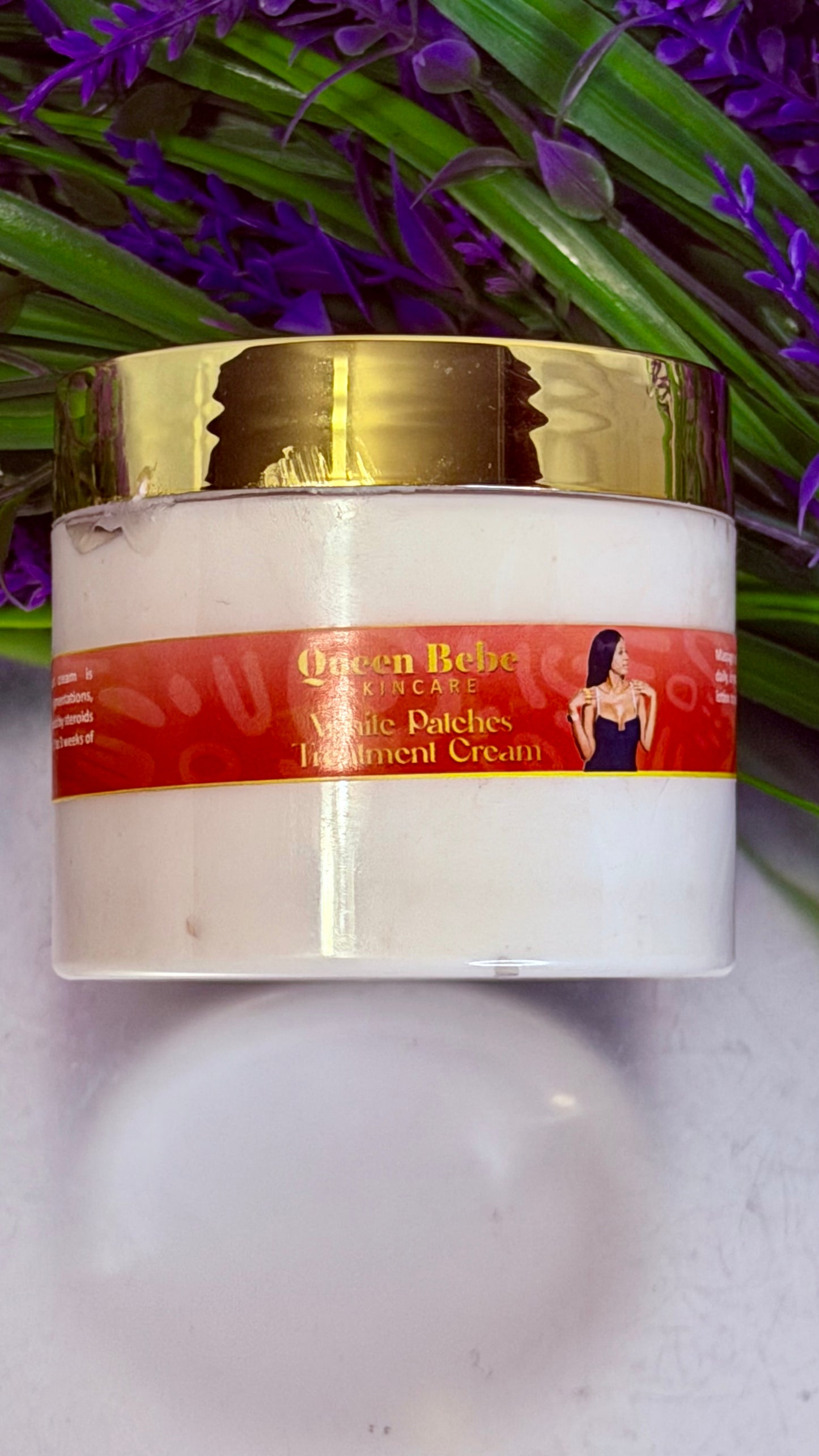 Queen Bebe Skincare White Patches/Dots Treatment Cream