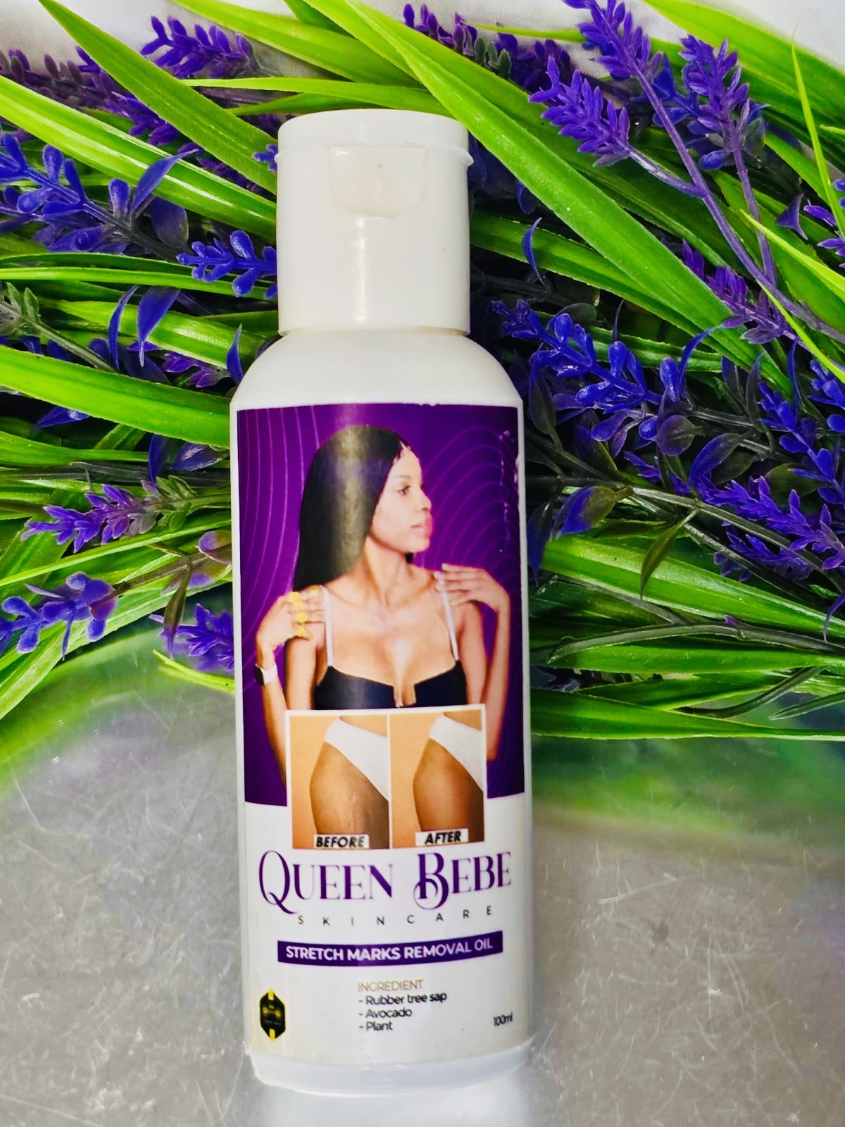100% Natural Stretch Marks Removal Oil