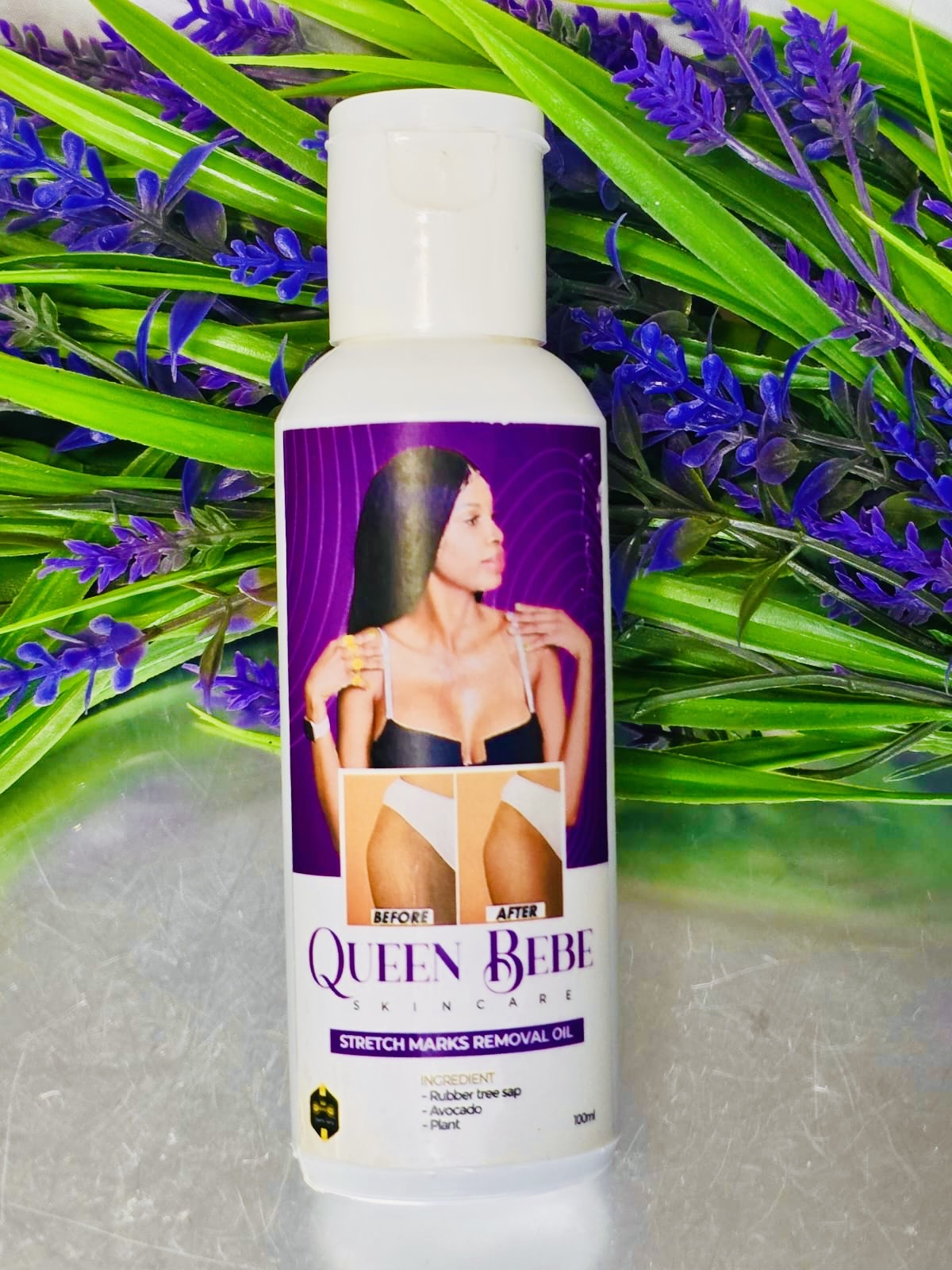 100% Natural Stretch Marks Removal Oil